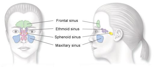 A diagram of the human sinuses.